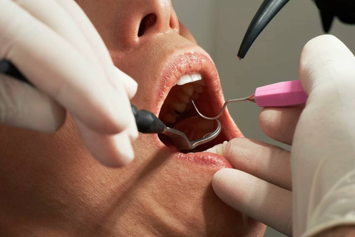 Free Dentures for Low-Income Adults: Programs That Help and How to Qualify