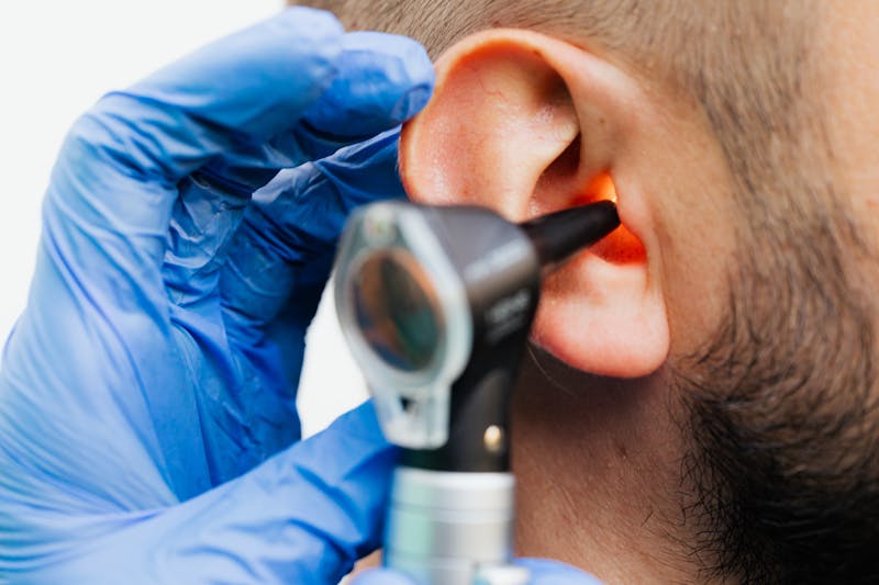 does medicaid cover hearing tests