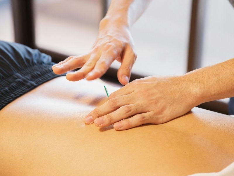 does medicare pay for acupuncture