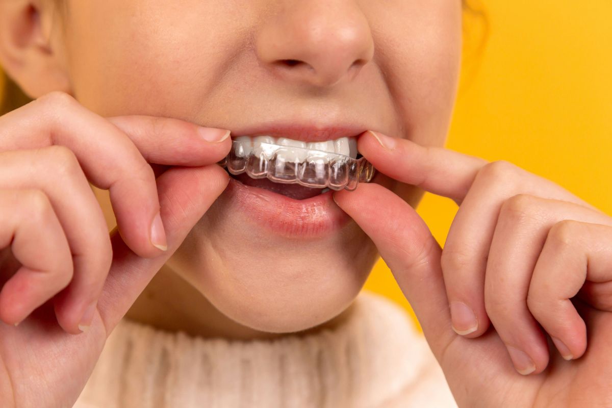 Does Medicaid Cover Braces? What Low-Income Families Need to Know