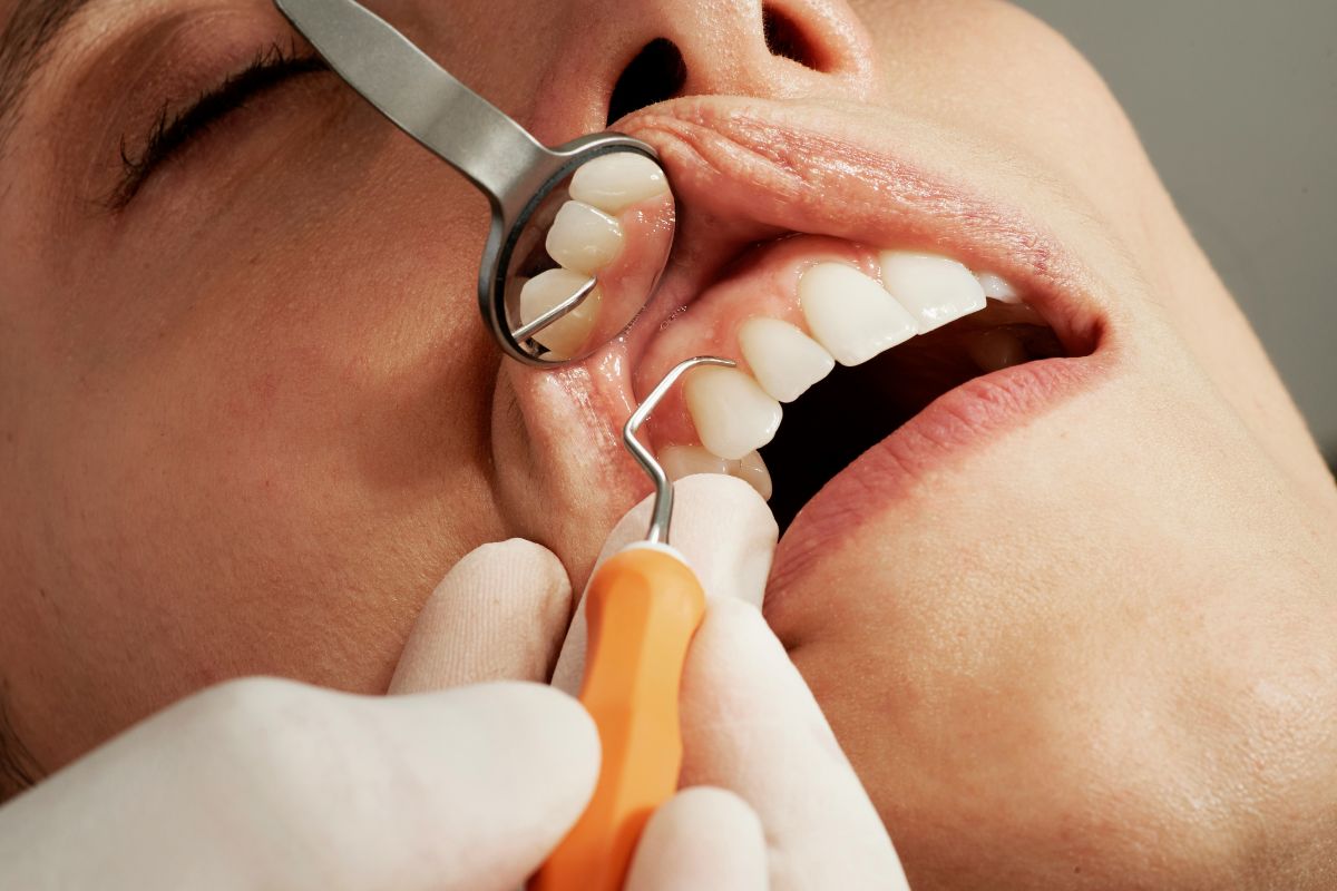 Does Medicaid Cover Dental Implants? The Truth About Dental Coverage