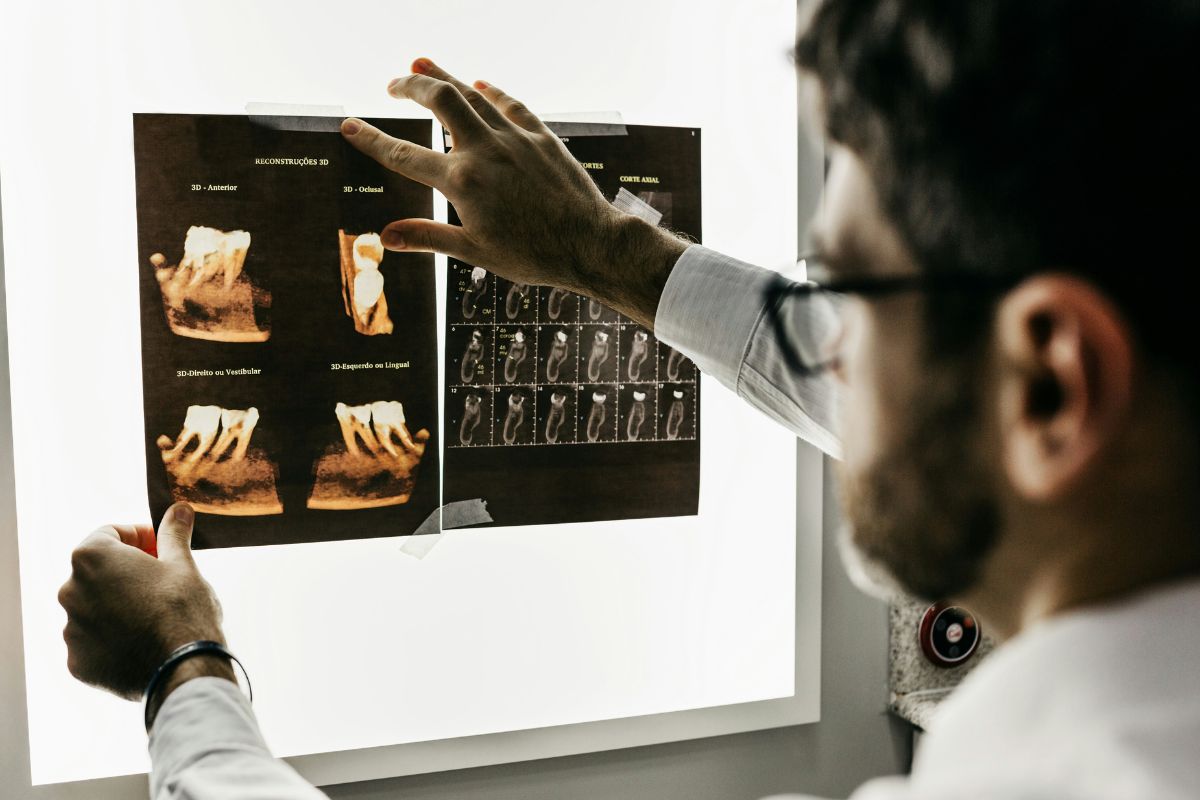 Does Medicare Cover Dental Implants? Costs & What to Do Next